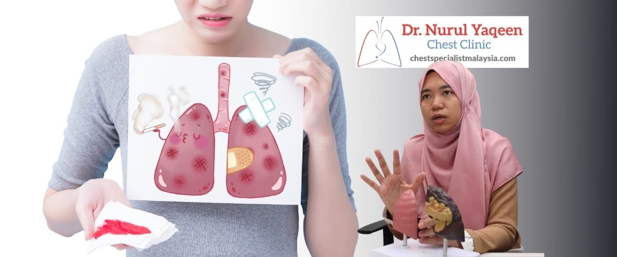 Kanser Paru-paru di Malaysia - Punca, Gejala & Rawatan
